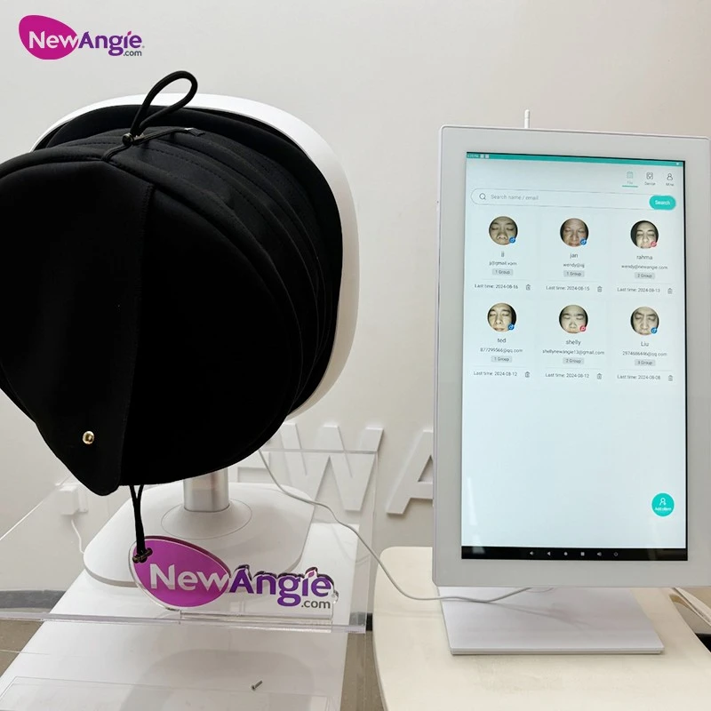 Facial Skin Analyzer Wholesale